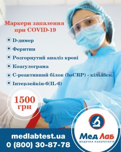 Маркери запалення при COVID-19
