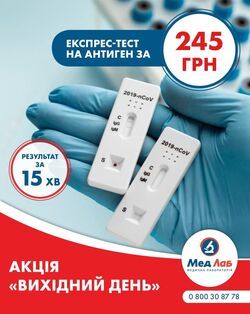Eкспрес-тест на антиген до COVID-19 
